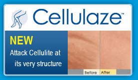 Cellulaze